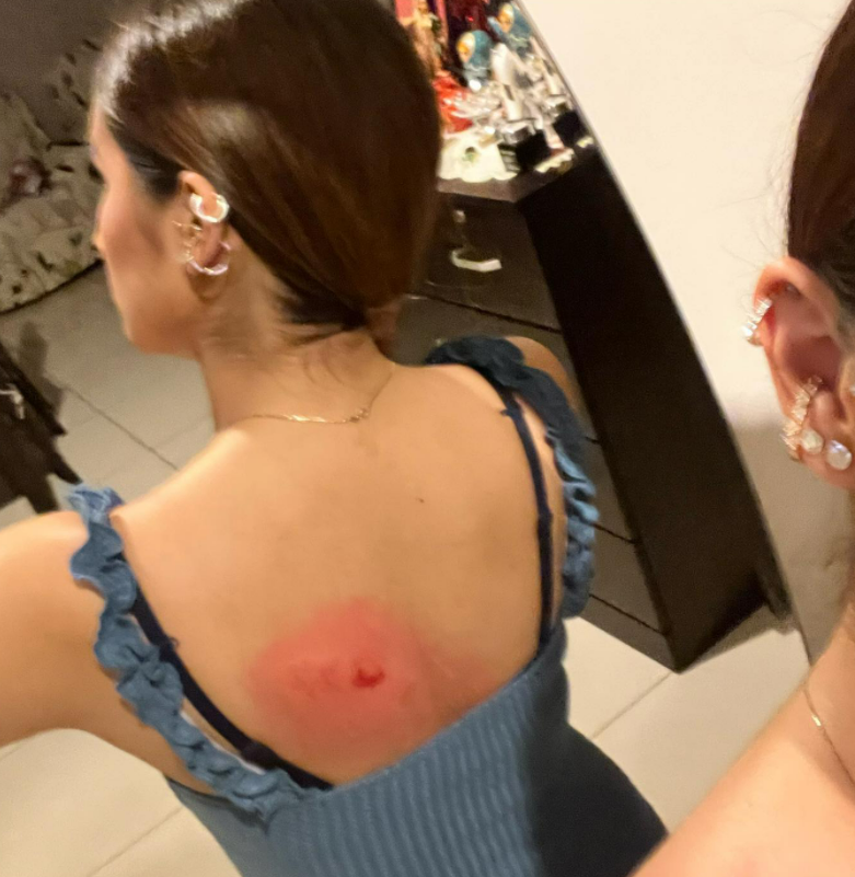 Female student harassed and attacked by two men at dutamas after ignoring their catcalling | weirdkaya